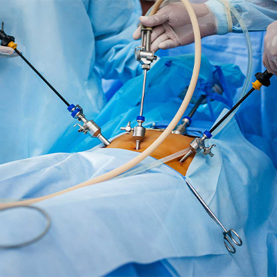 best-Gynecologic Laparoscopy-in-gorakhpur