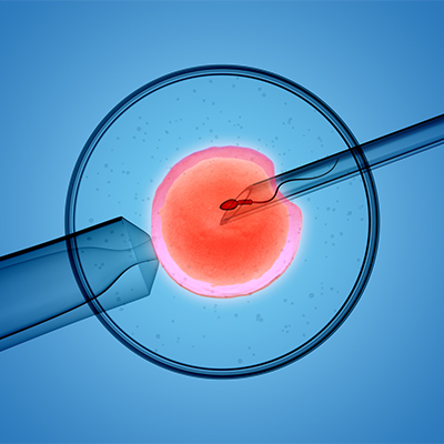 best-Infertility Treatment-in-gorakhpur