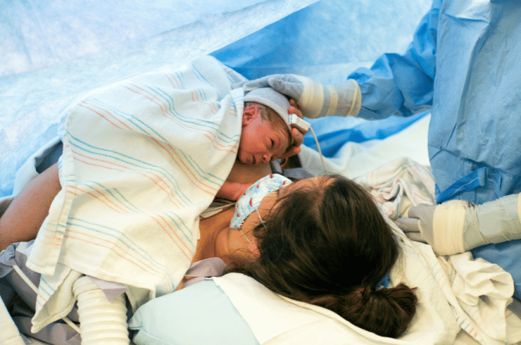 C-section