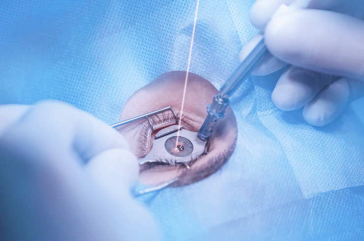 Refractive Surgery & LASIK